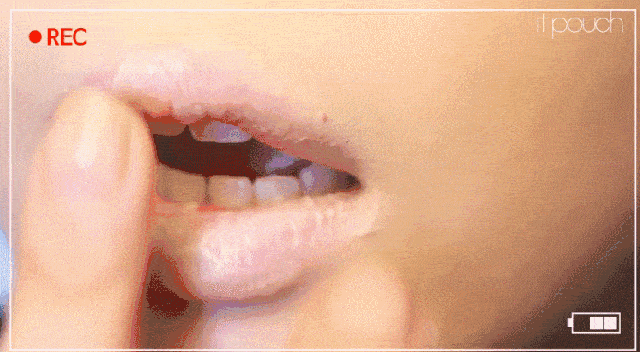 直白来说,就是嘴唇干裂起皮已经到了非常严重的地步,看起来像干树皮一